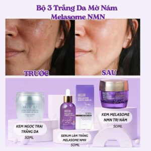 Alternative view of BỘ 3 TRẮNG DA MỜ NÁM MELASOME NMN